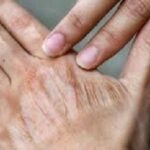 چگونه از خشکی پوست در پاییز جلوگیری کنیم؟